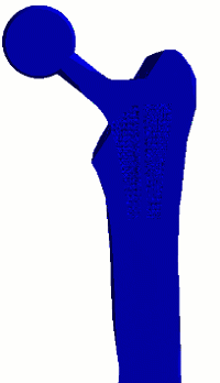 gif implant